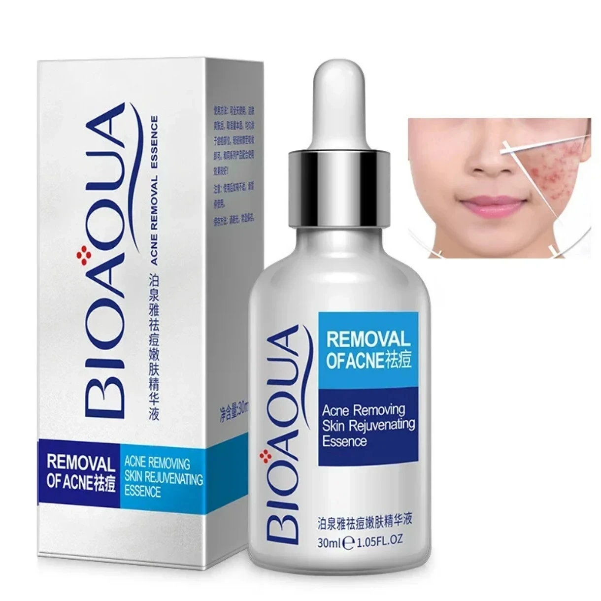 🌿 Bioaqua Acne Rejuvenation Essence — Piel más limpia, calma y renovada ☺️💖30 ml