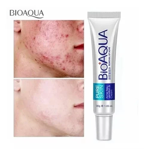 Crema para el acné bioaqua 🤗🌺💕 5