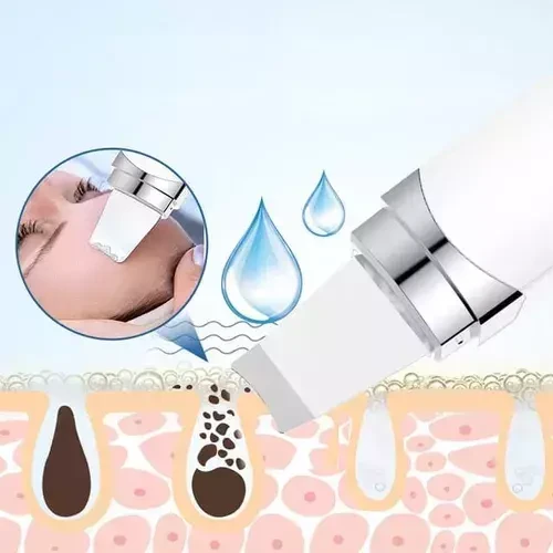 Pala Facial Exfoliante Ultrasonica 4