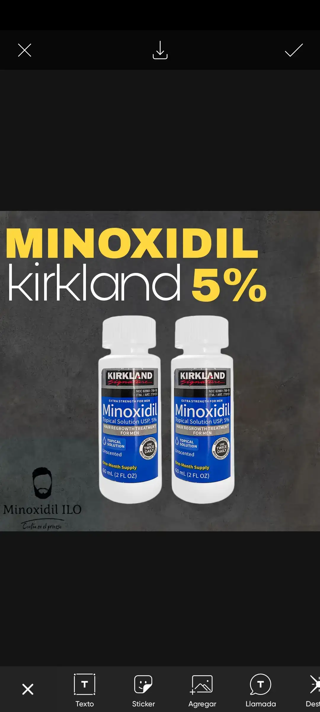 Minoxidil kirkland 