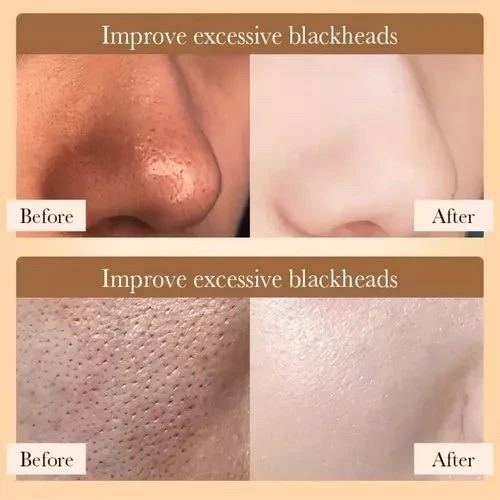Mascarilla Facial de Arroz Bioaqua  2