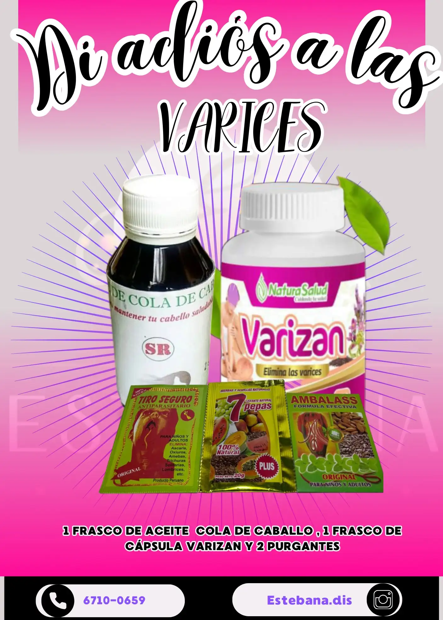 Varices