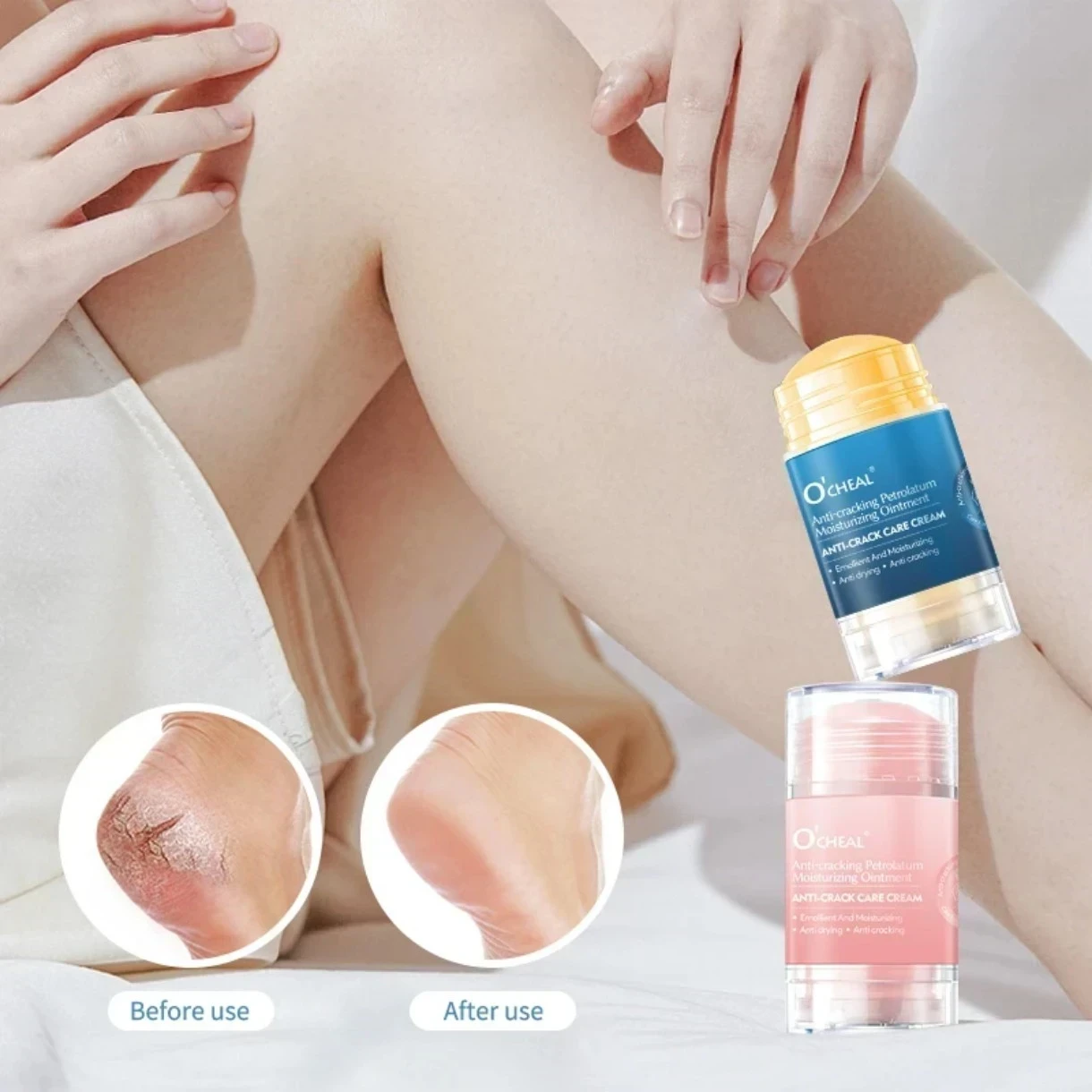 🧴 O’Cheal Anti-cracking Petrolatum Moisturizing Ointment – 40g 4