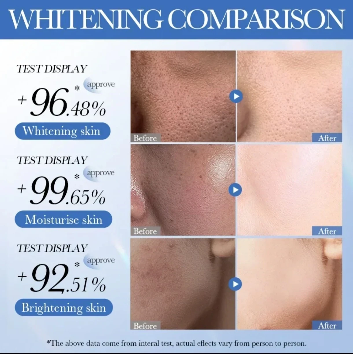 SADOER White Rice Lotion – Hidratación profunda y luminosidad 💞🥰 2