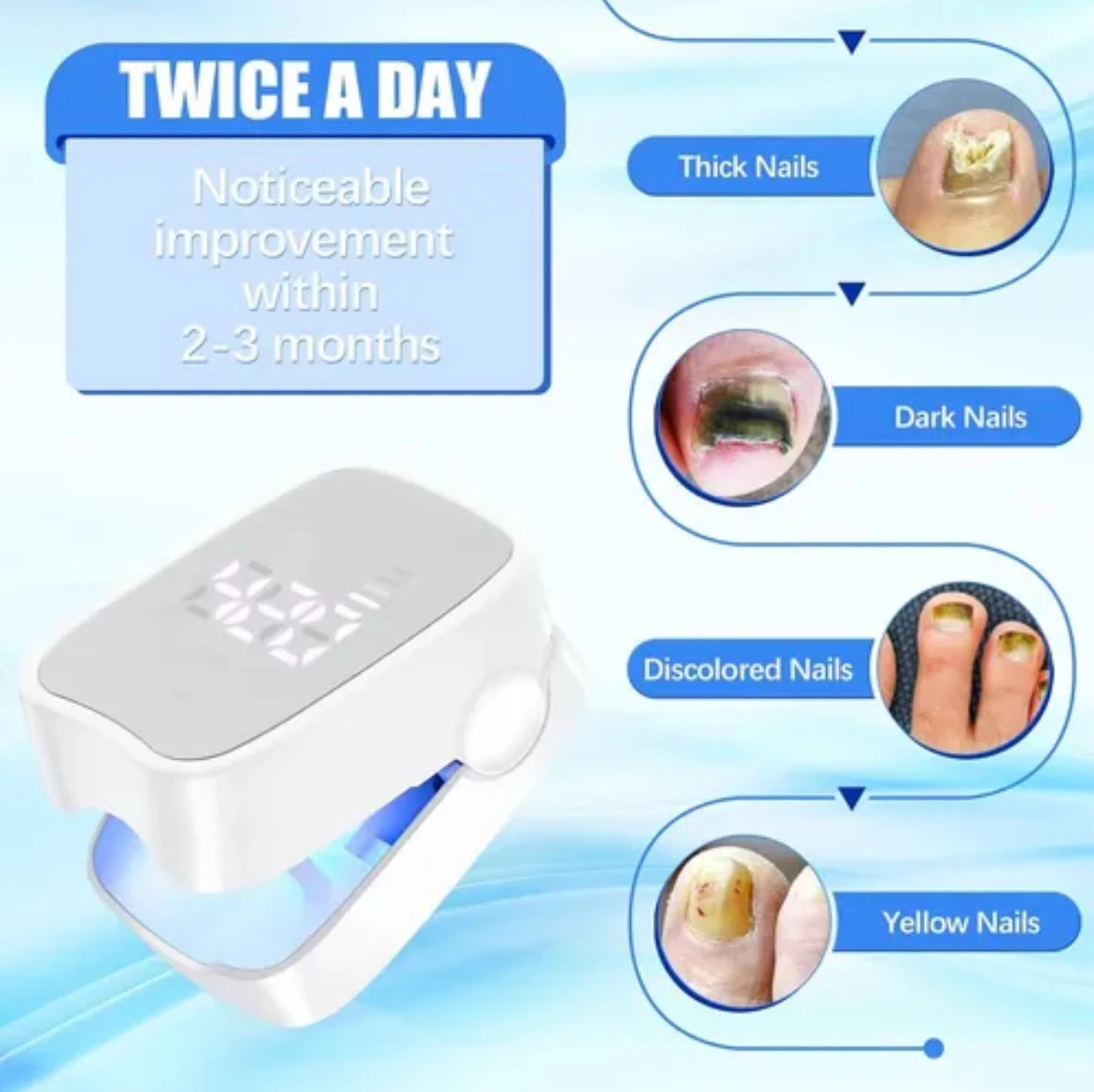 Dispositivo laser para el tratamiento de uñas 6