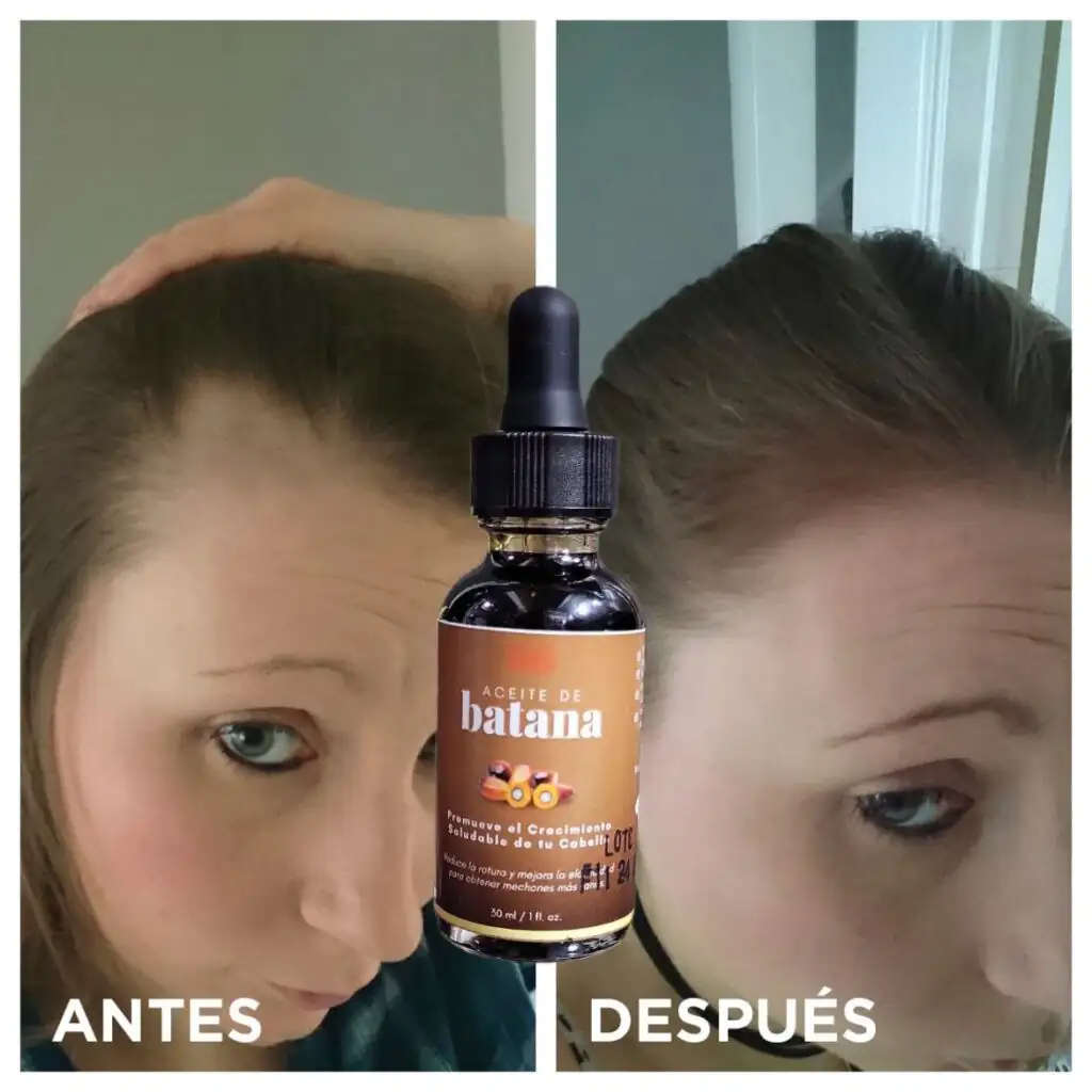 Aceite de Batana 