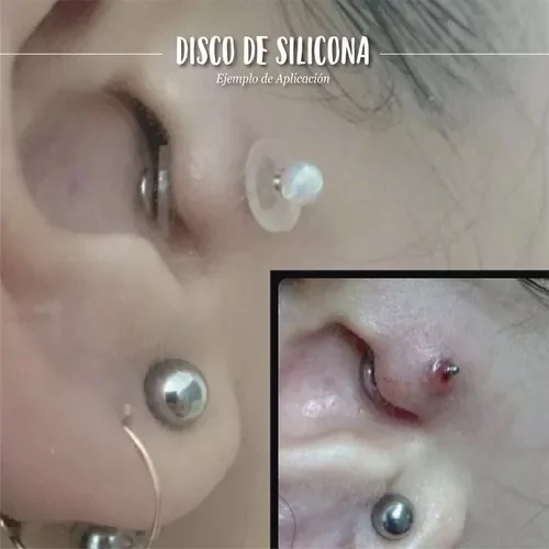 Discos Silicona Biocompatible Reduce Queloides 4