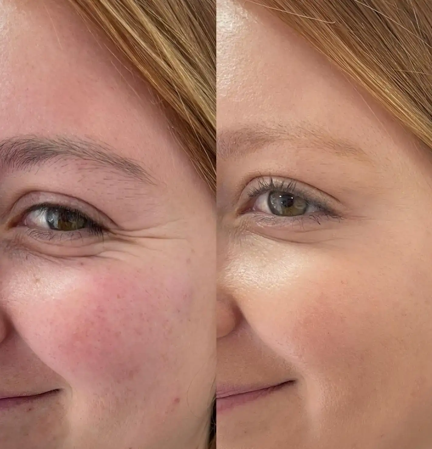 😍 ROUTINE DERMO BOOSTER EFECTO TENSIONADOR 😍 2