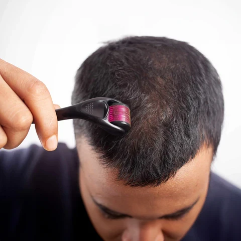 Dermaroller 0.5mm para estimular el crecimiento en barba y cuero cabelludo 4