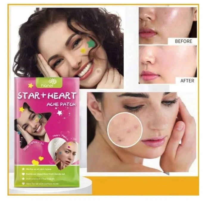 PARCHE ANTIACNE