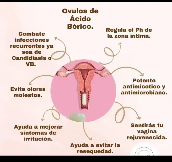 5 dias de tratamiento acido bórico