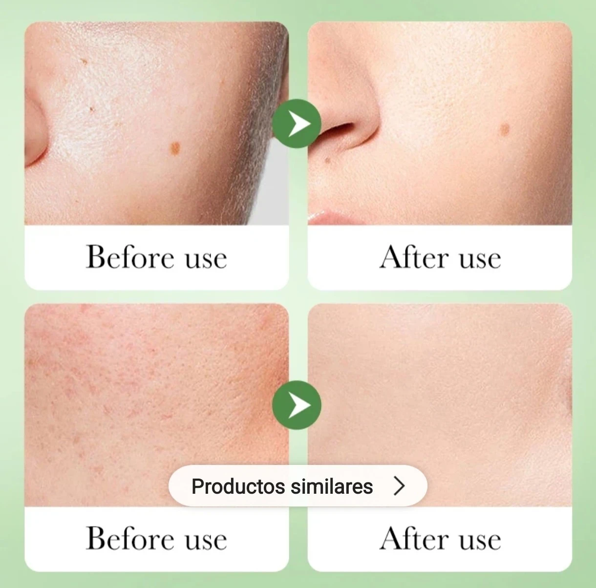 BIOAQUA Centella Asiática – Soothing Repair Lotion 🥰🌸 4