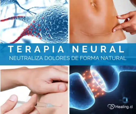 Terapia Neural 