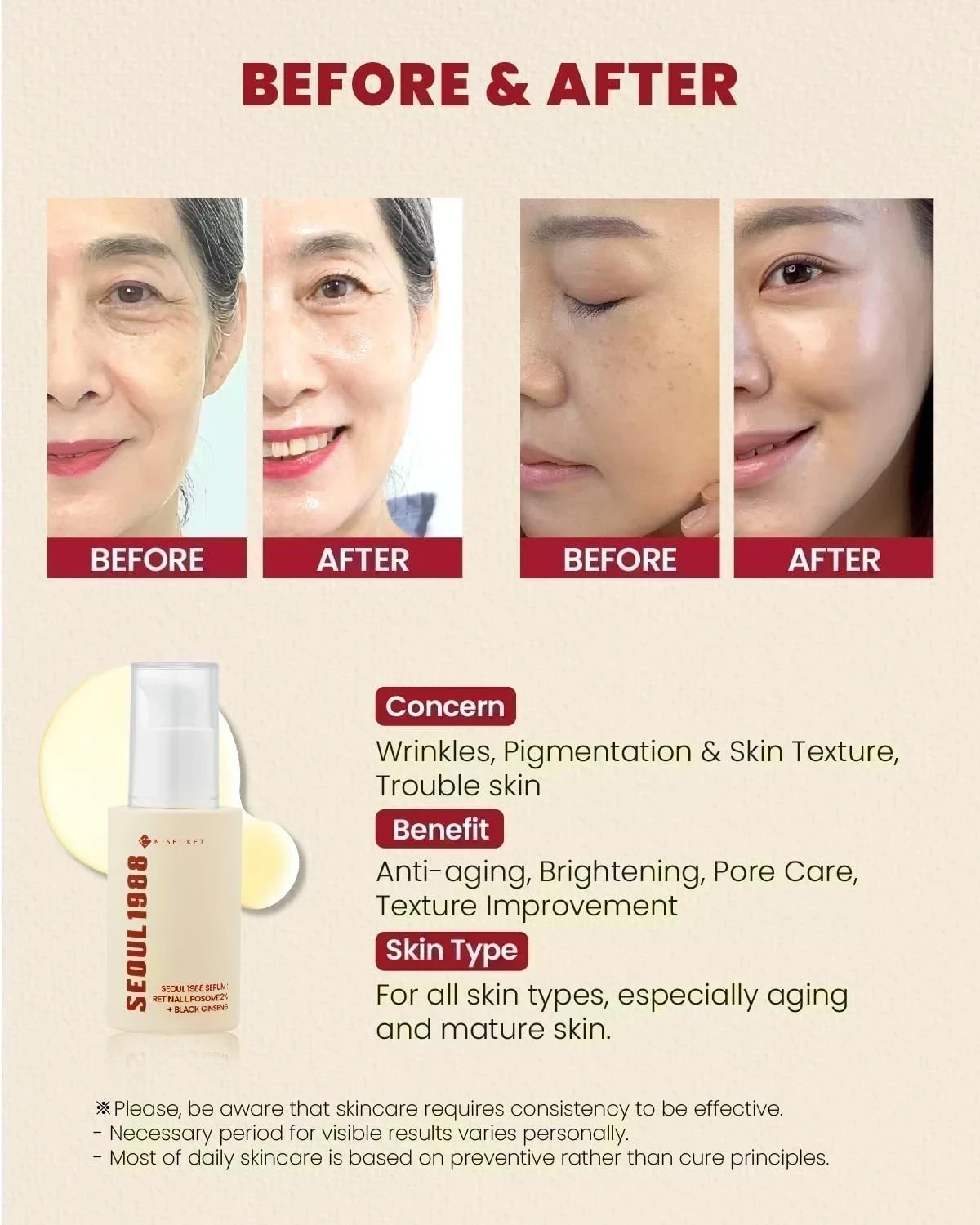 KSECRET - SEOUL 1988 Serum : Retinal Liposome 2% + Black Ginseng [30ml] 3