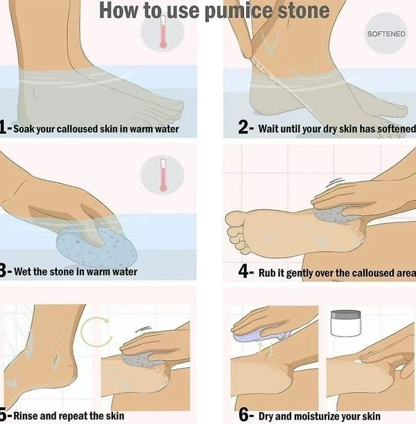 Piedra pómez para pies, cuidado de los pies 3