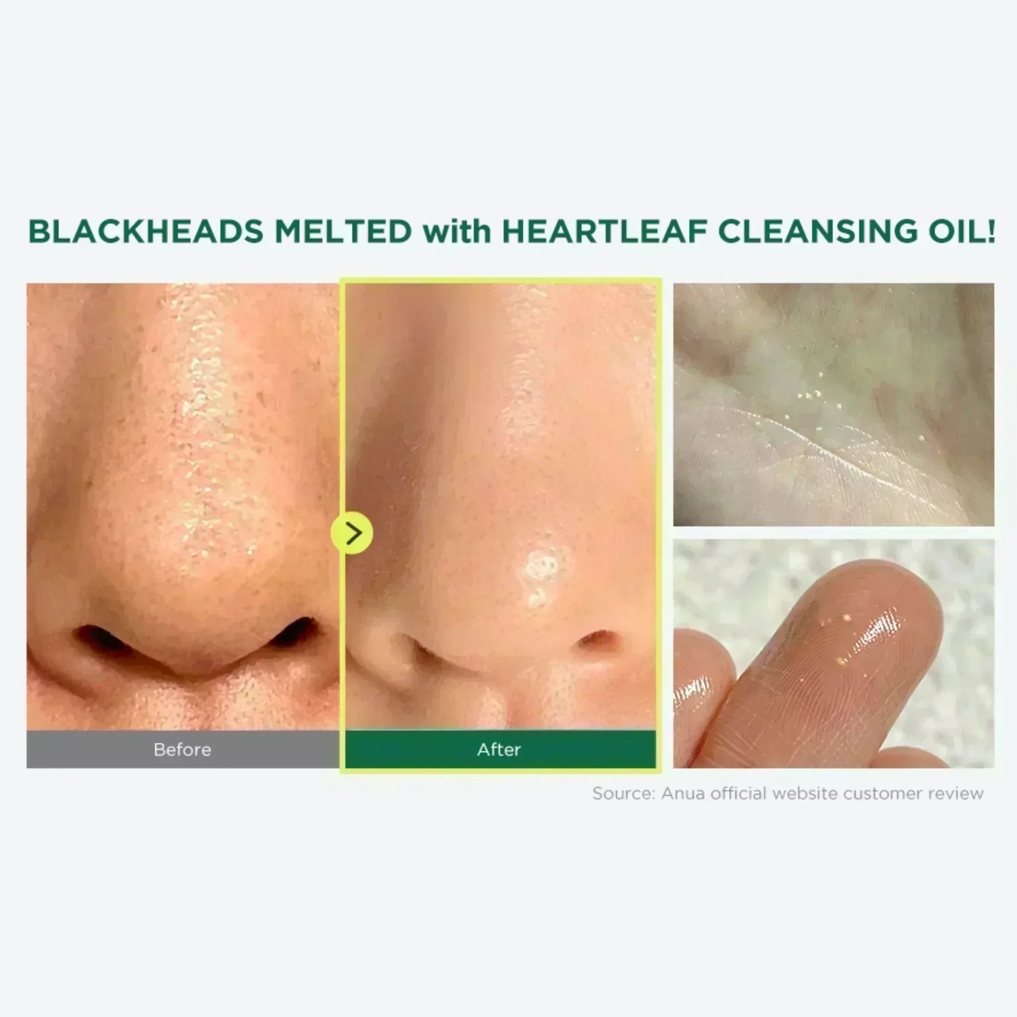 Anua HEARTLEAF PORE CONTROL CLEANSING OIL, 200ml 3