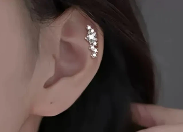 Aretes