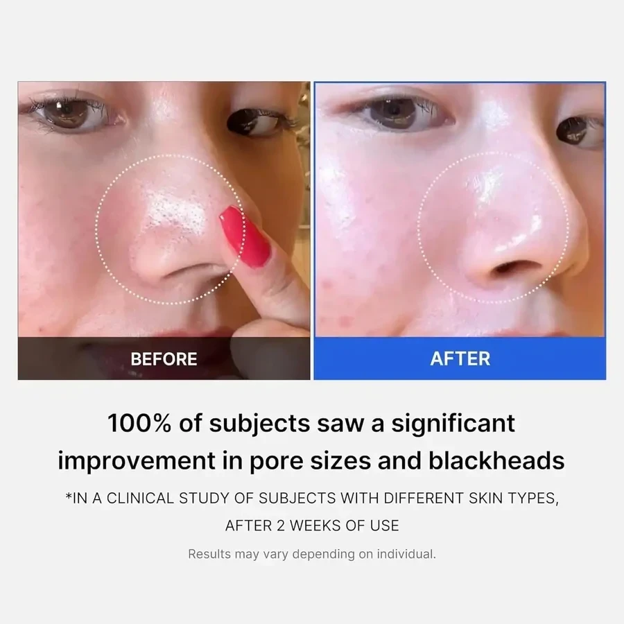 MEDICUBE | Zero Pore Pad 2.0 - 70 ud 3