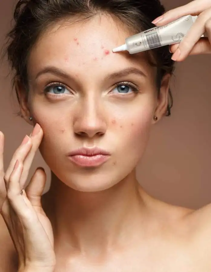 💕 ROUTINE DERMO GEL FACIAL SECADOR PARA ESPINILLAS💕 2