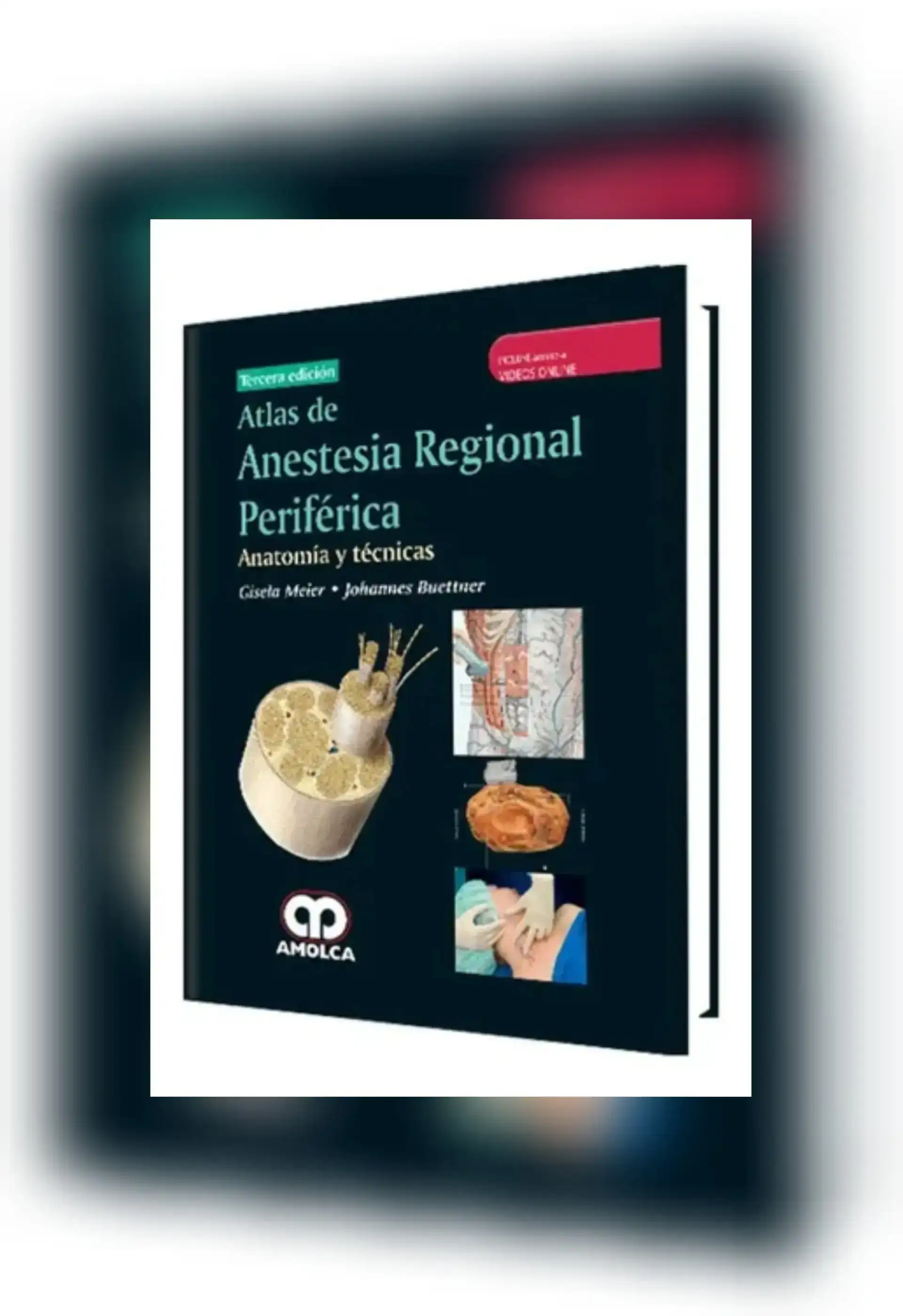 Atlas de anestesia regional periférica 