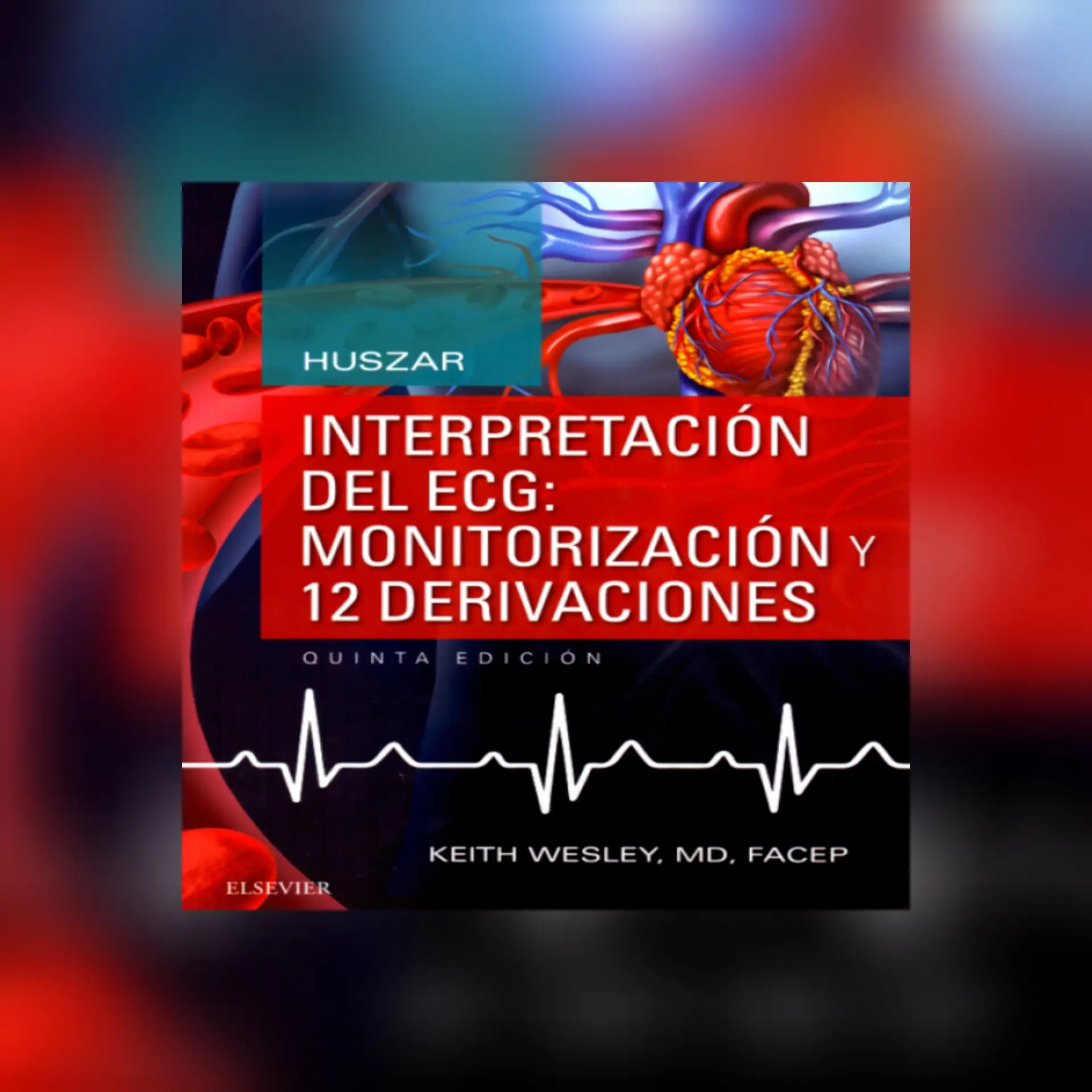 Interpretación del ECG