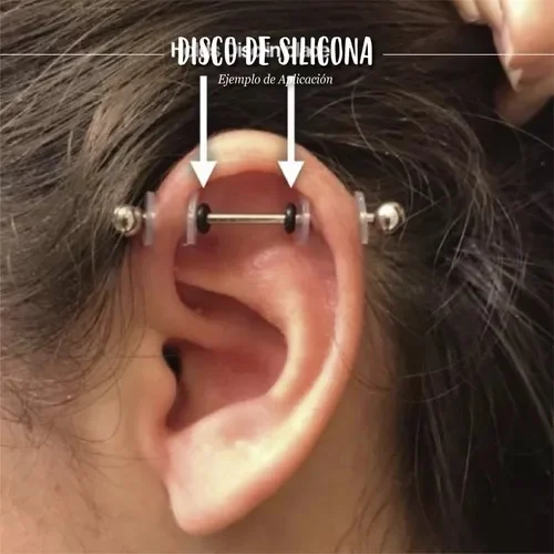 Discos Silicona Biocompatible Reduce Queloides 9