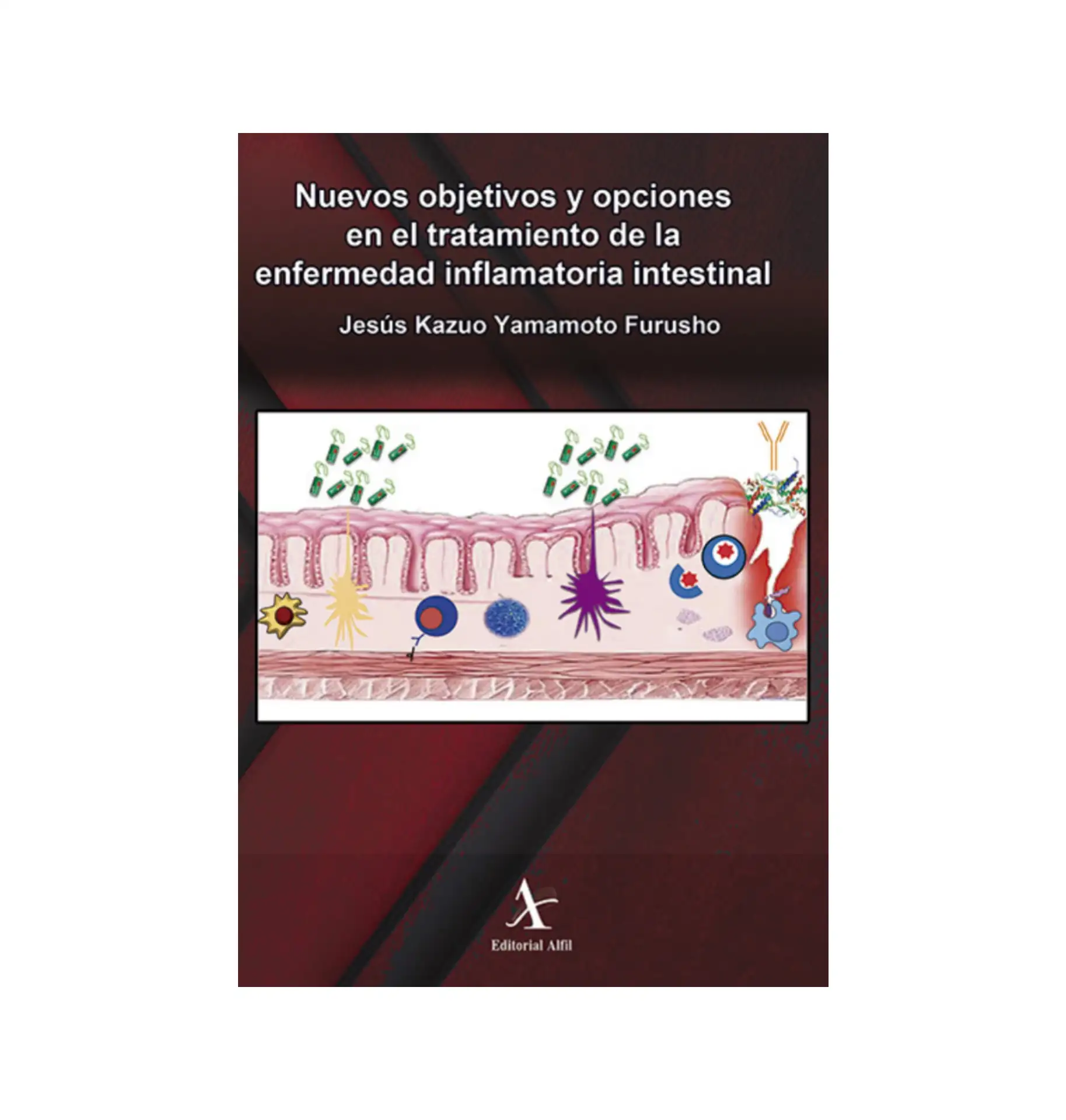 Nuevos objetivos y opciones en el tratamiento de la enfermedad  inflamatoria intestinal 