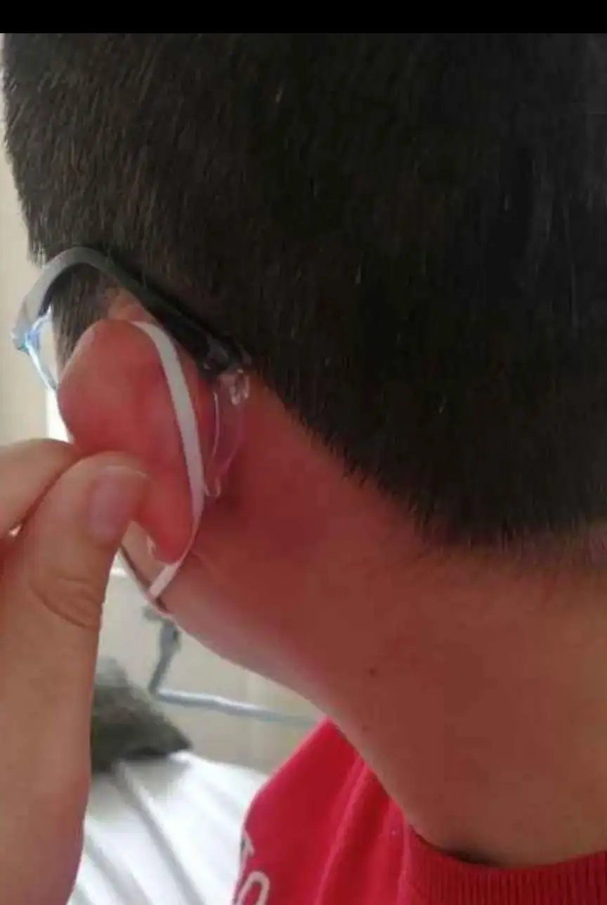 Sujetador de Lentes  3