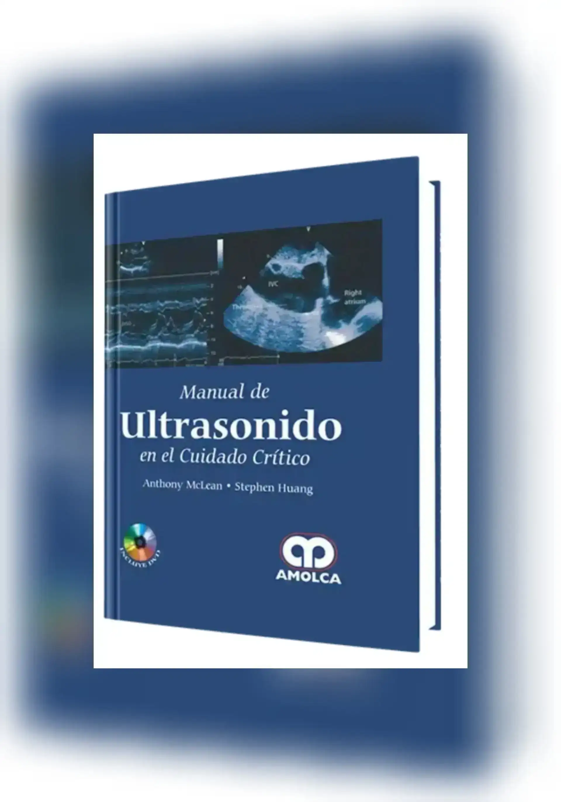 Manual de ultrasonido en el cuidado critico