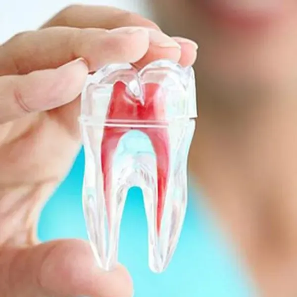 ENDODONCIA