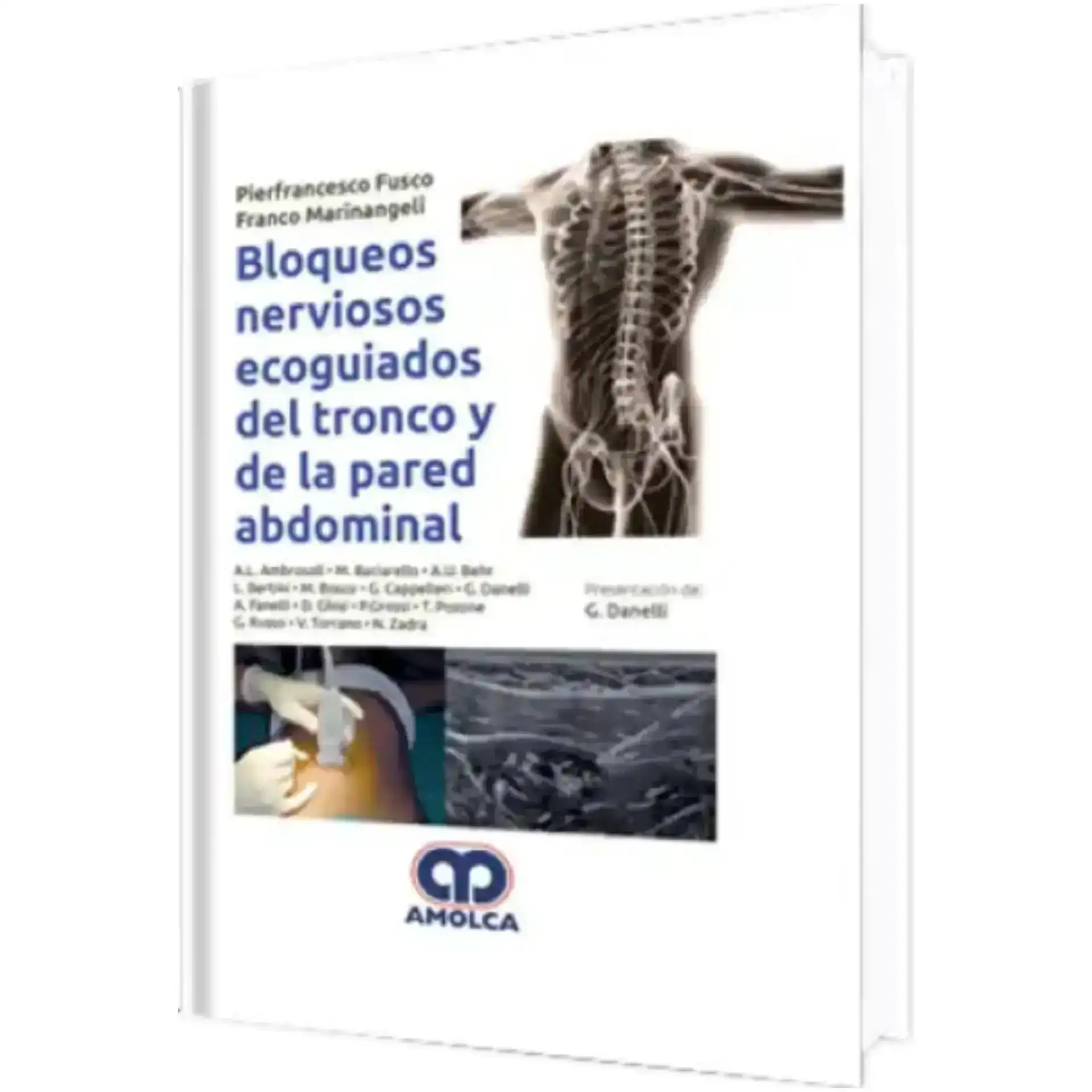 Bloqueos nerviosos ecoguiados 