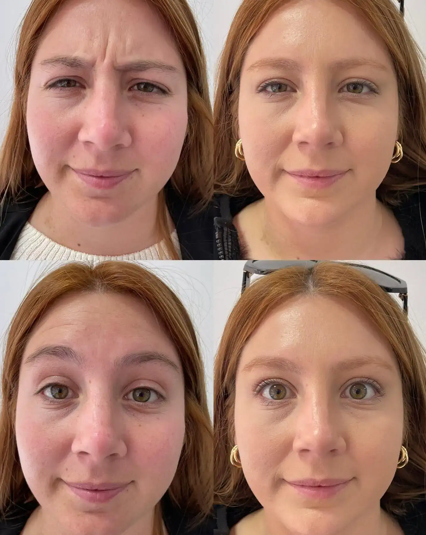 😍 ROUTINE DERMO BOOSTER EFECTO TENSIONADOR 😍 3