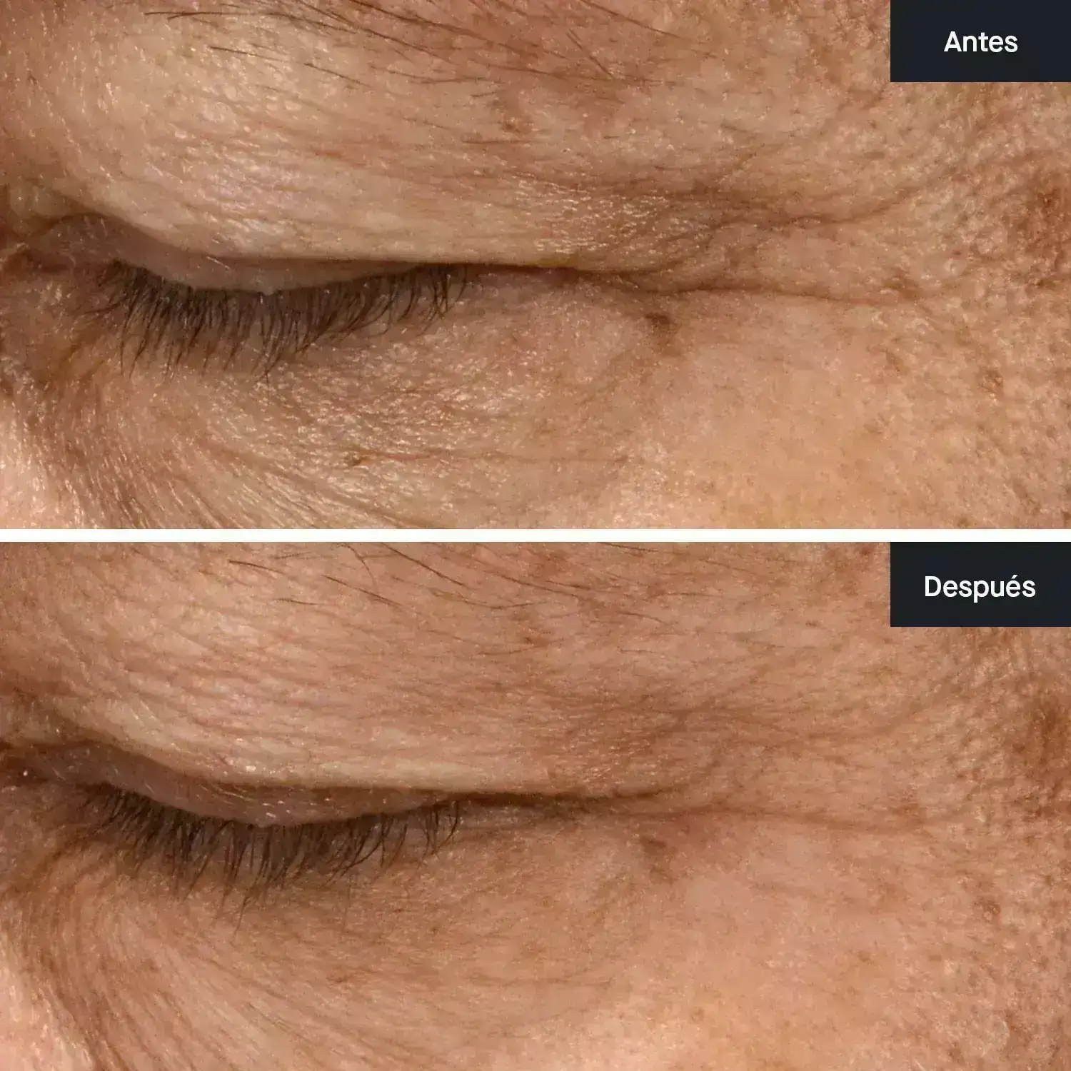 Concentrado Rejuvenecedor para Ojos Sentiva Extracto Divino 2