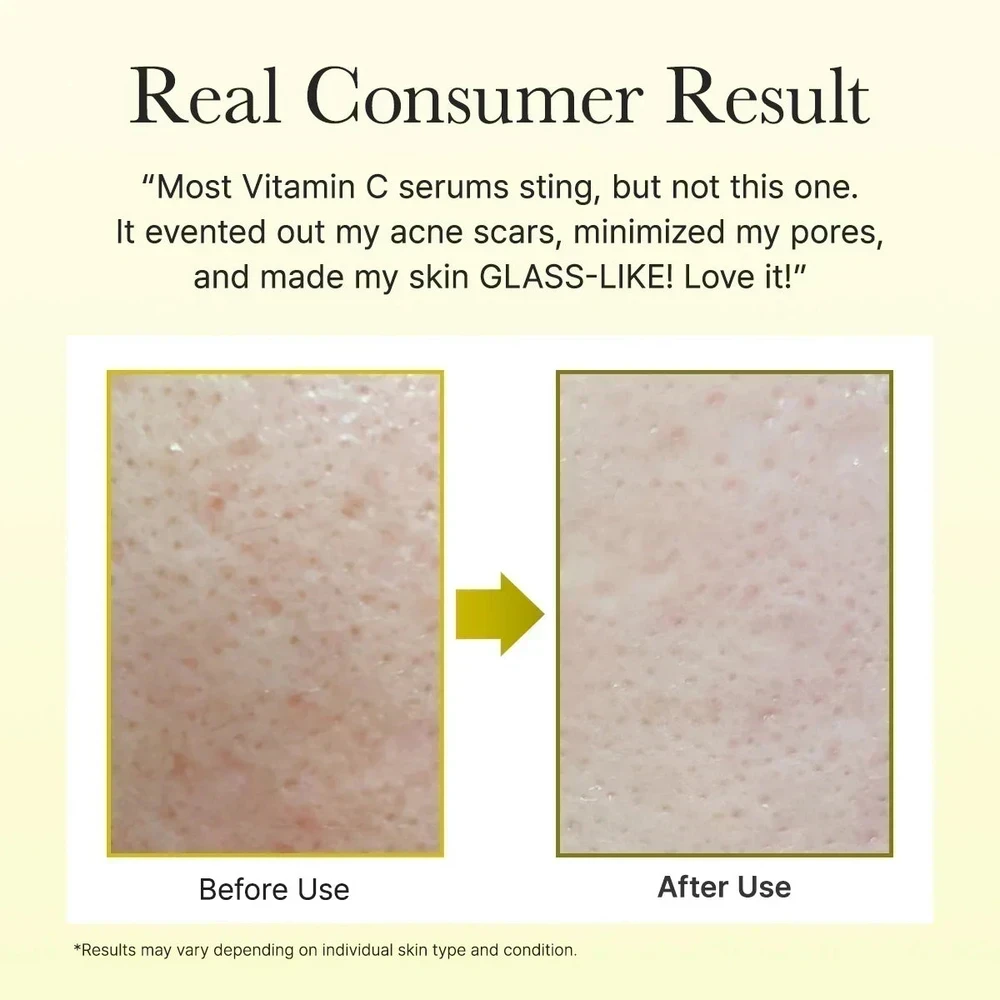 ARENCIA - Vitamin C Booster Shot 30 ML 2