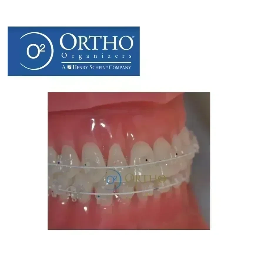 BRACKETS CERAMICOS ROTH ILLUSION PLUS - ORTHO O. 2