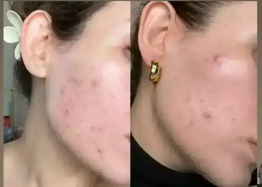 Crema Dr. Althea  4