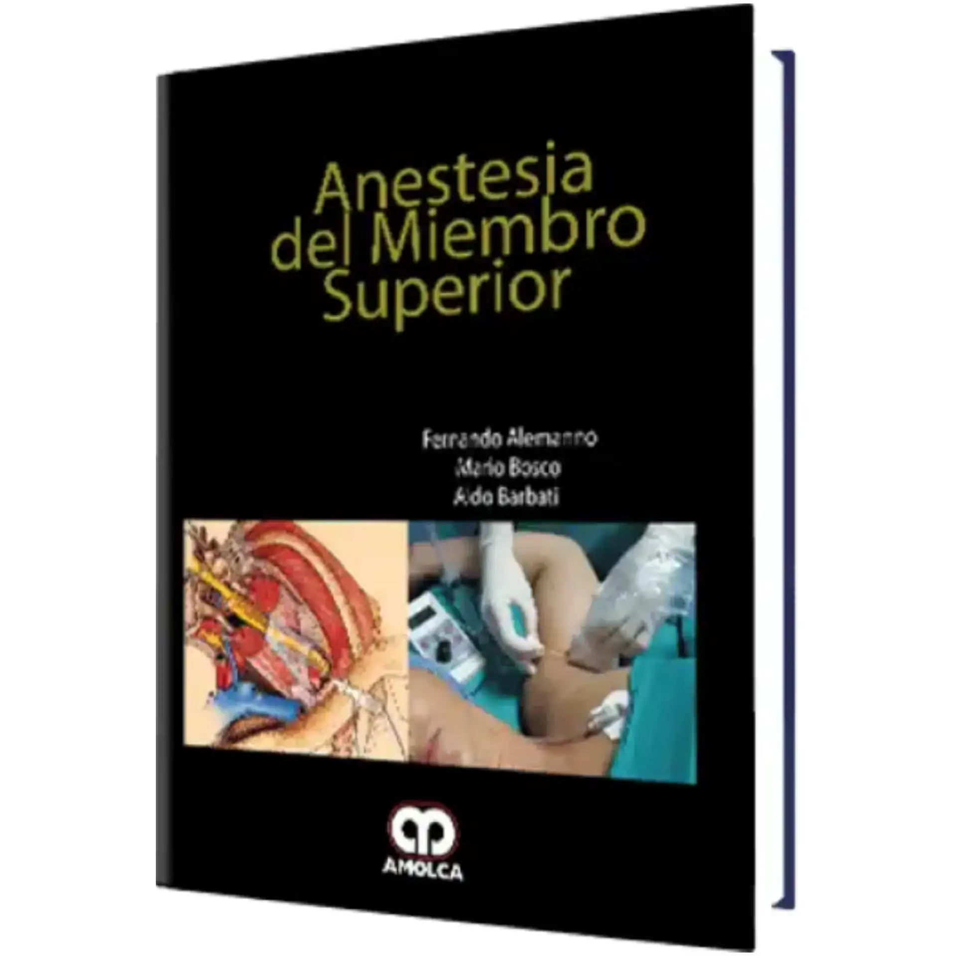 Anestesia del miembro superior