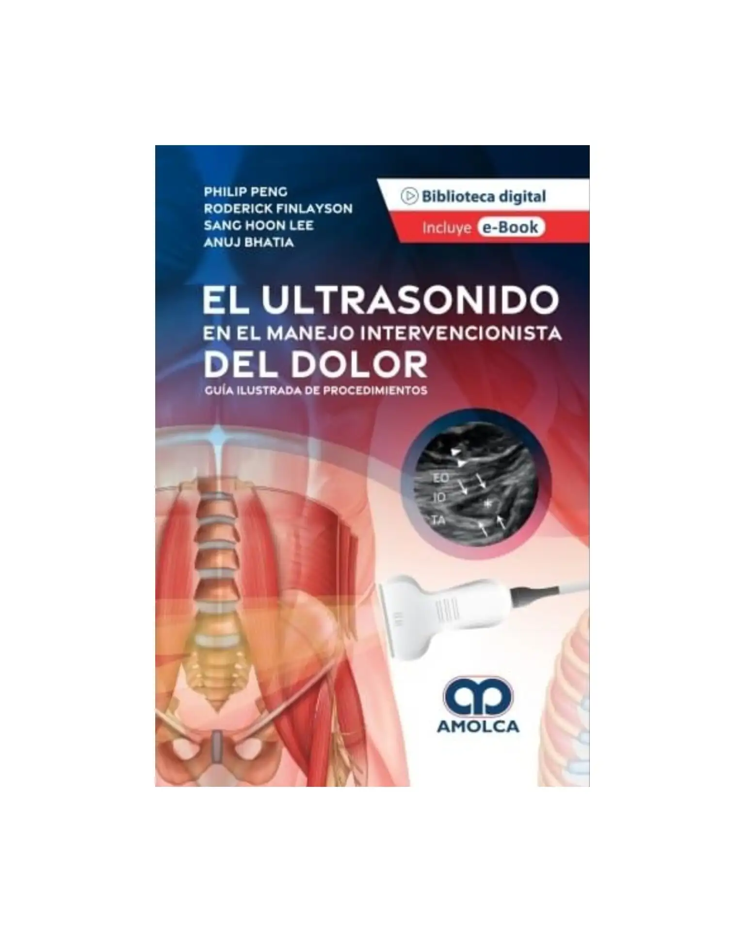 El ultrasonido en el manejo intervencionista del dolor