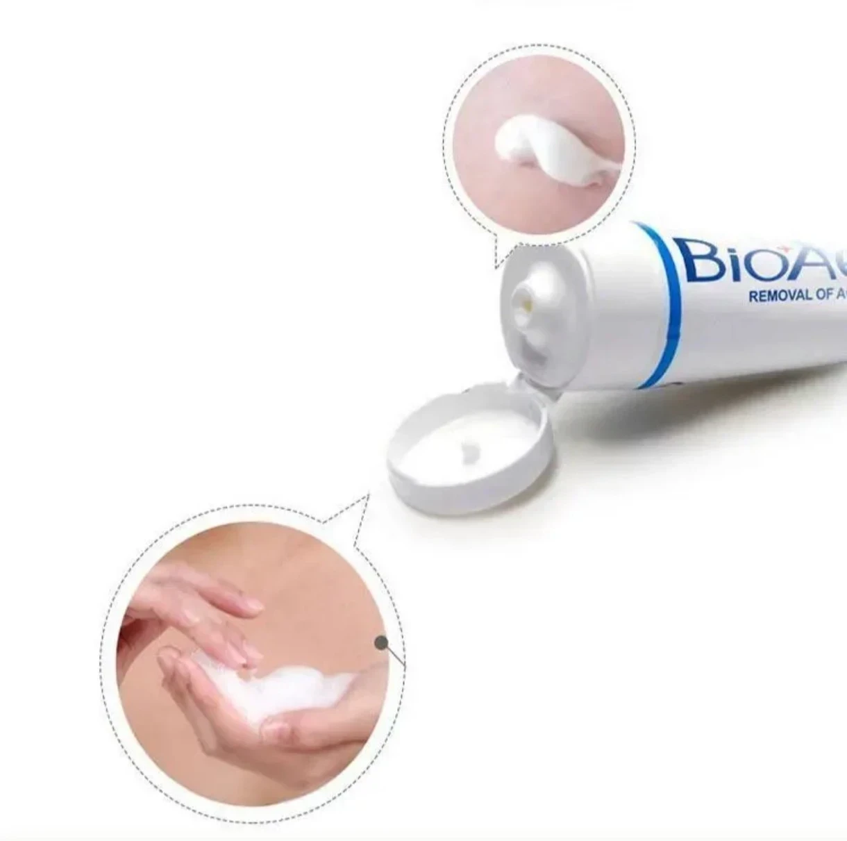 BIOAQUA Removal of Acne – Gel Facial Antiacné 100g ☺️ 2