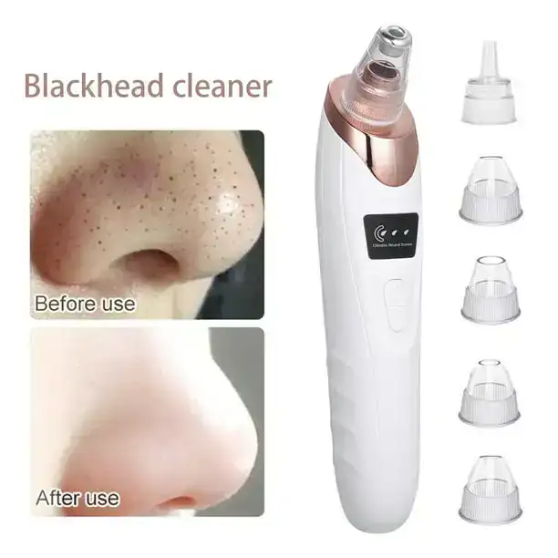 Extractor de puntos negros 