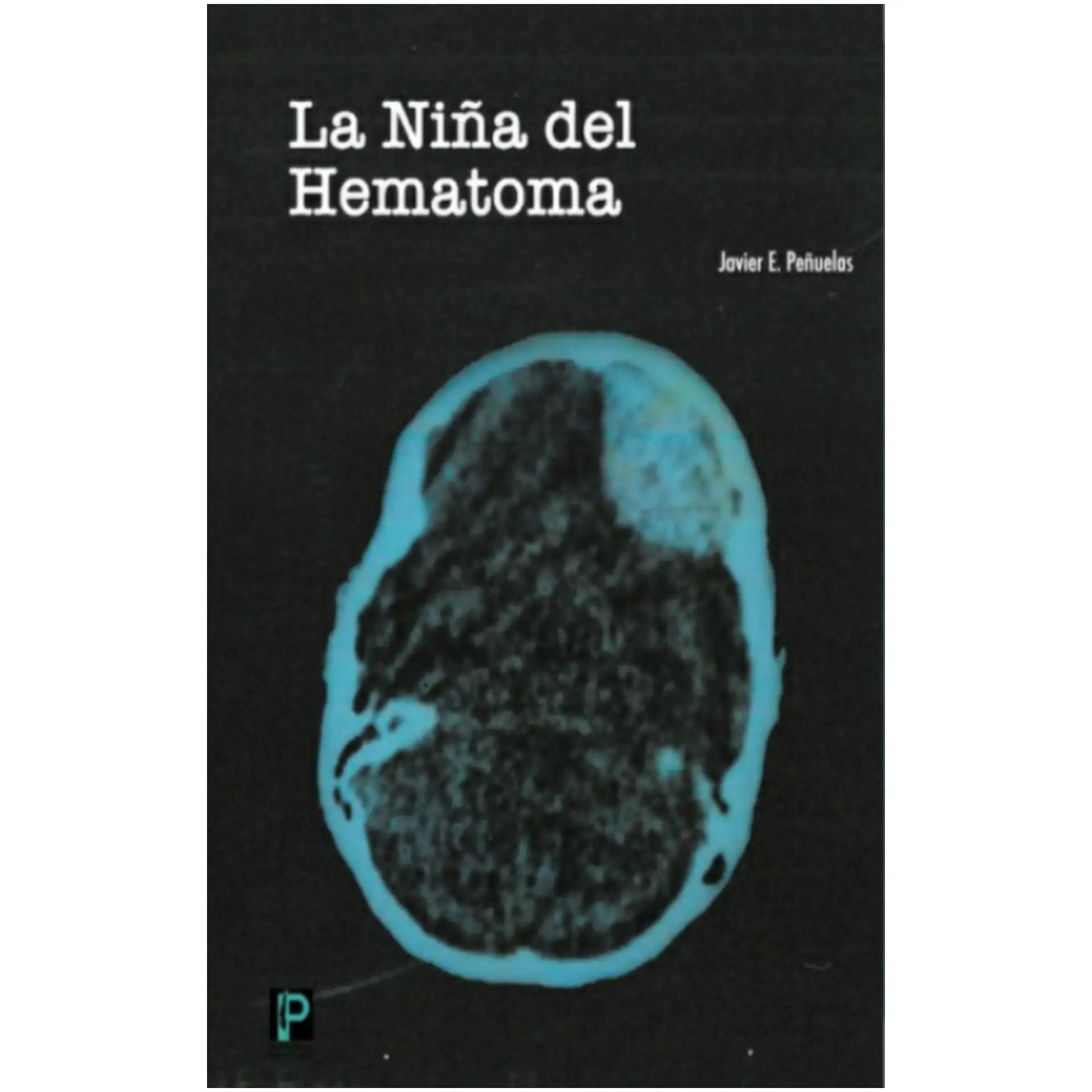 La Niña del Hematoma