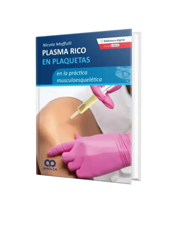 Plasma rico en plaquetas en la práctica musculoesquelética
