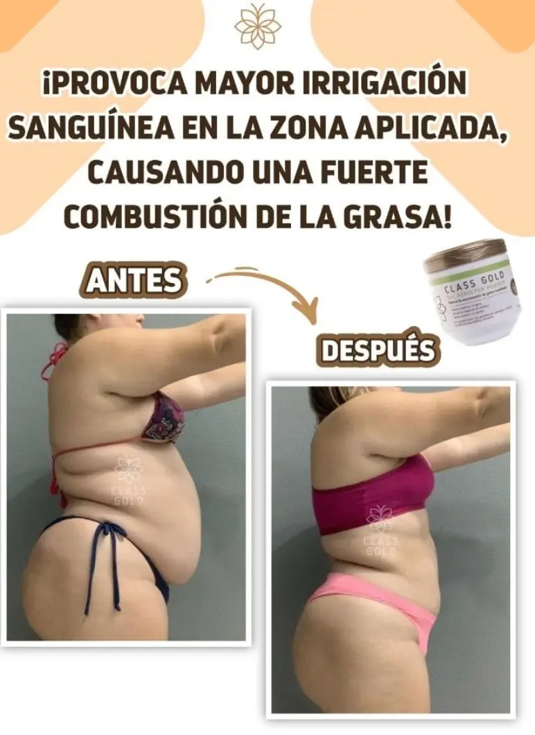 Crema para las estrías y adelgazar  3