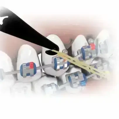 Posicionador + elástico intra oral 