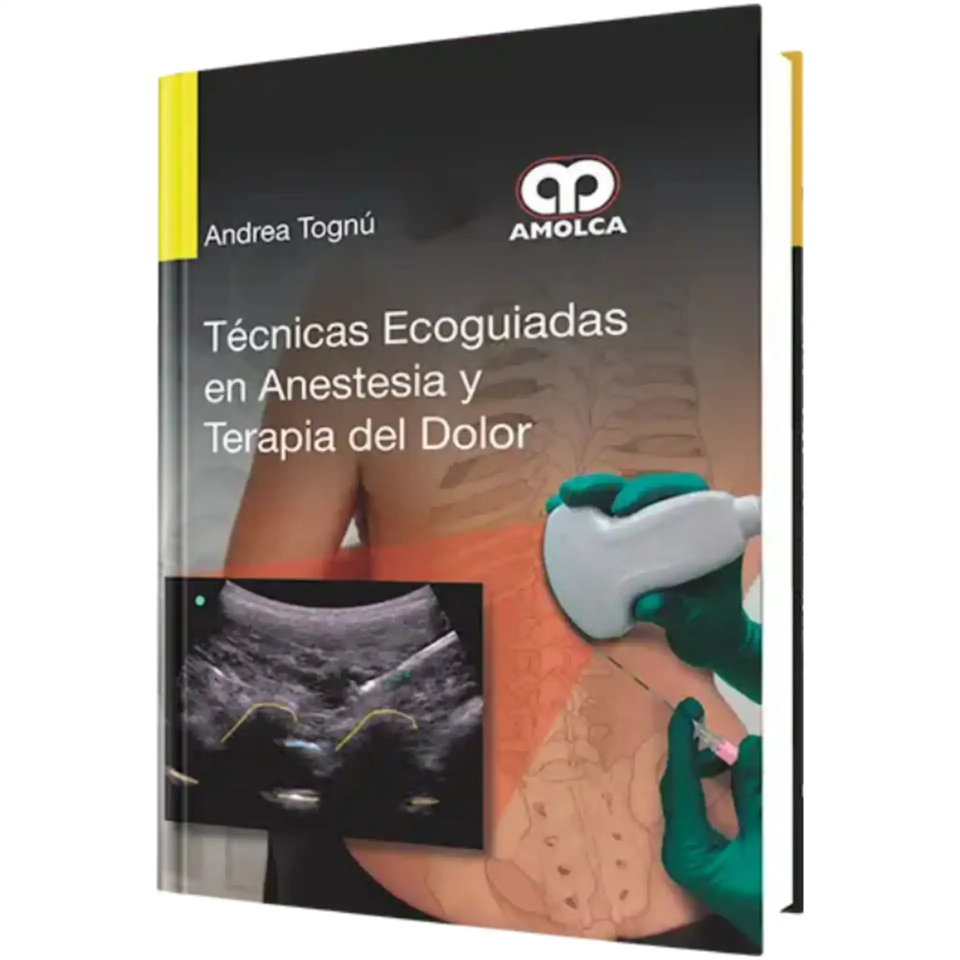 Tecnicas ecogiadas de anestesia y terapia del dolor 