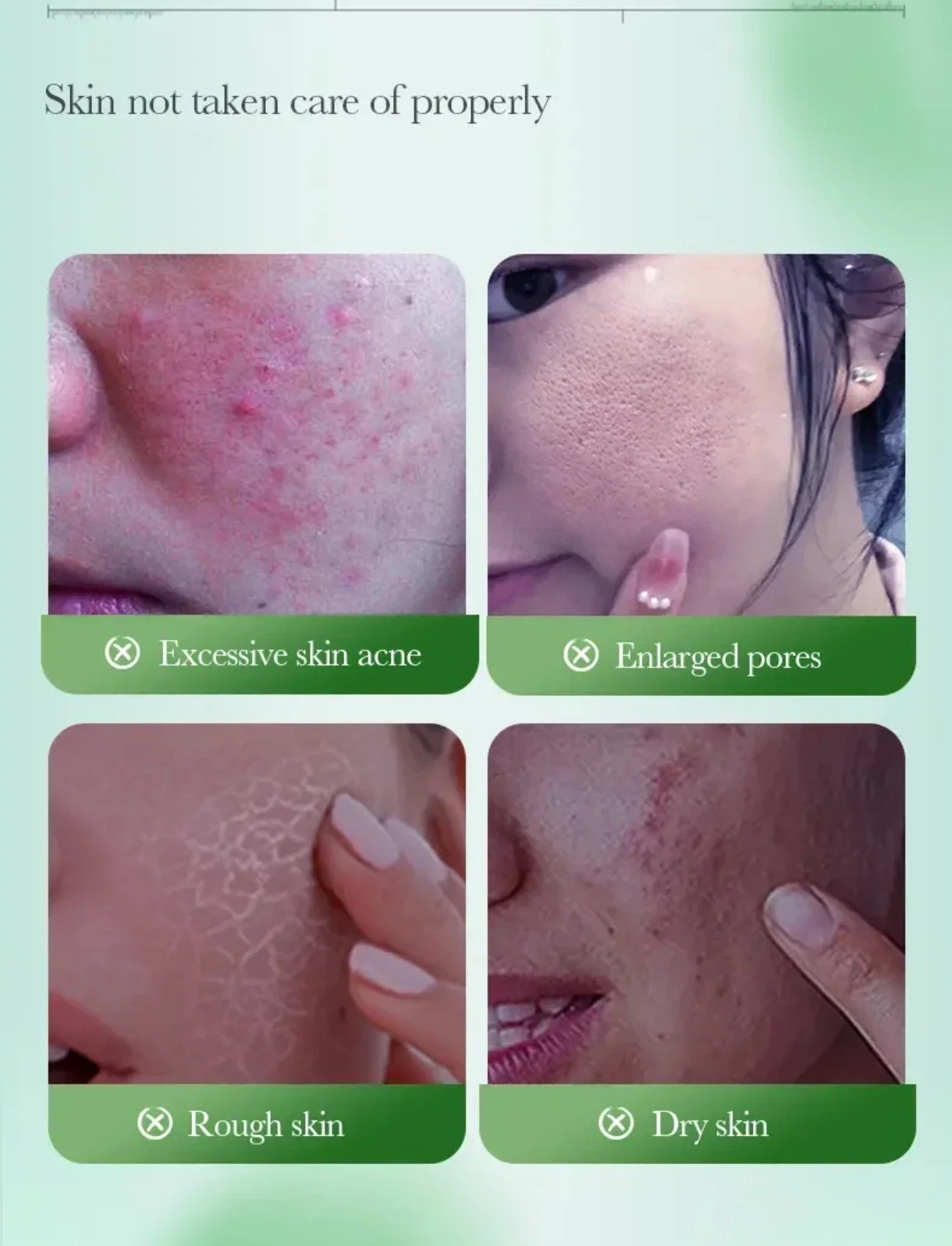 Mascarilla de té verde 🌿 sodoer ✨☺️💞 3