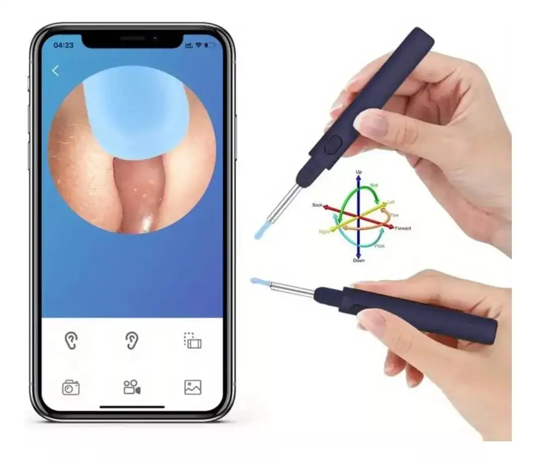 Limpiador smart de oído con cámara  2