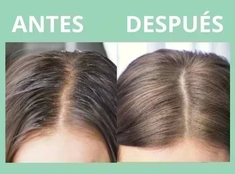 SHAMPOO EN SECO - BONVITA 150 ml ☺️  5