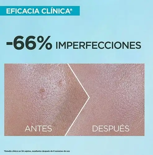 Protector Solar Súper UV Anti Imperfecciones FPS 50 - Garnier  3
