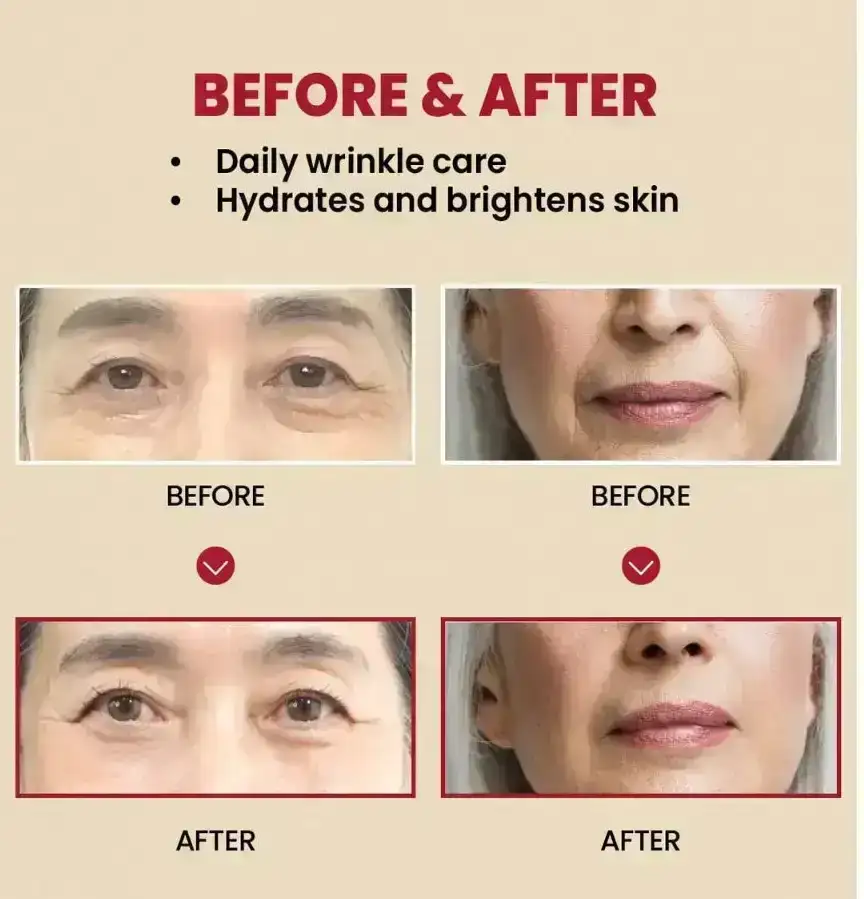 KSecret – Crema SEOUL1988 para el Contorno de Ojos con Retinal y Fermented Bean (30ml) 4